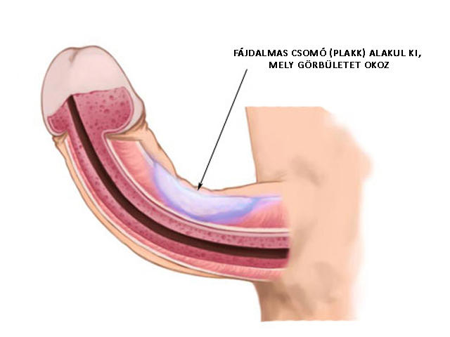 Can You Use a Tens Unit on Your Penis to Improve ED?